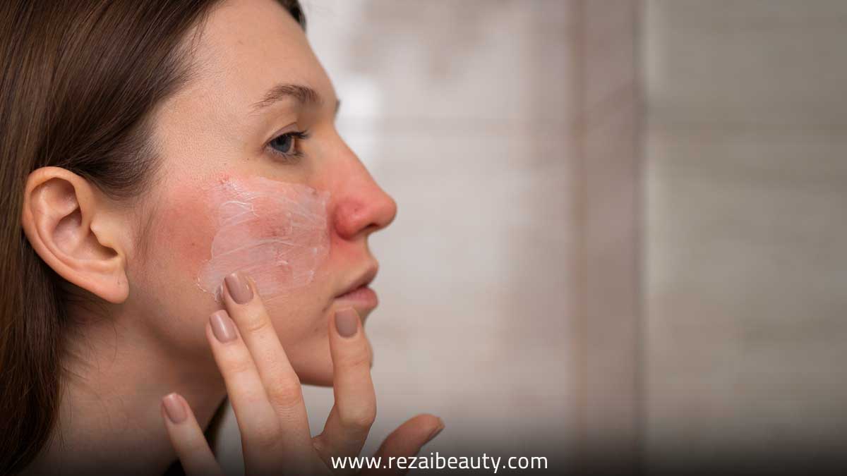 بهترین شوینده صورت برای پوست خشک