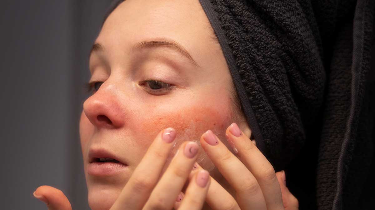 نکات مهم در استفاده از شوینده برای پوست خشک
