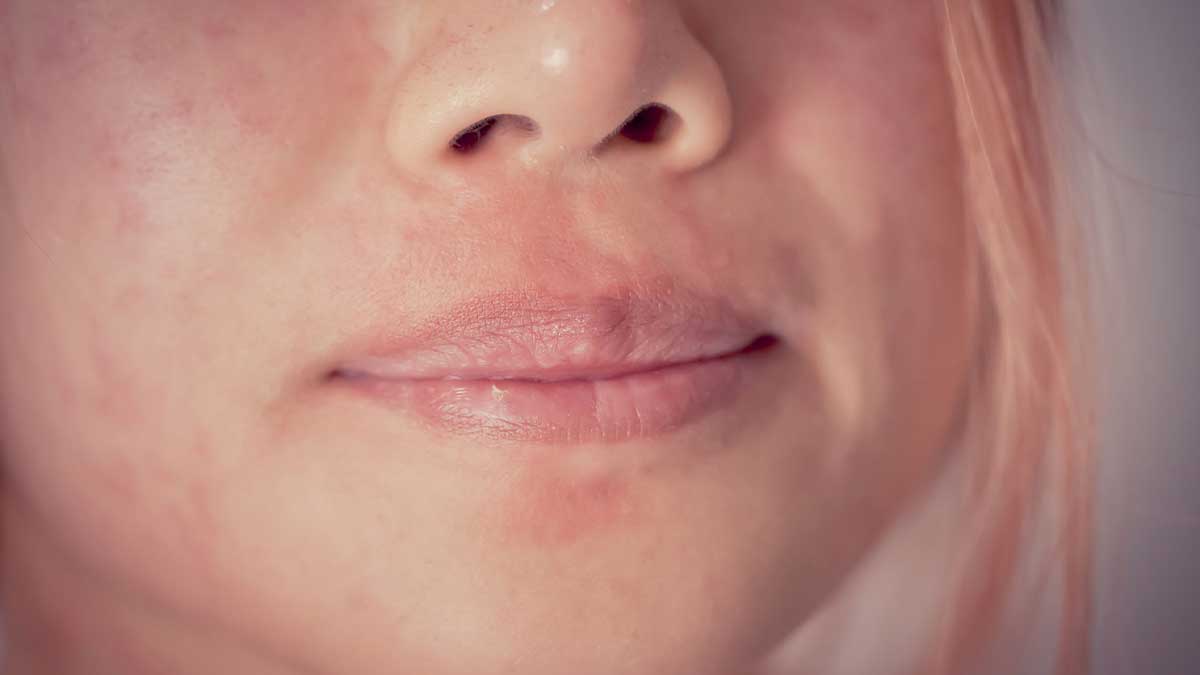 ساختار سد دفاعی پوست