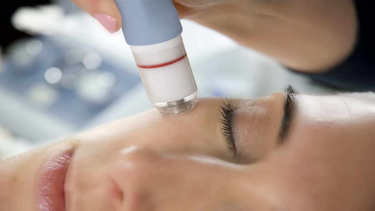 دستگاه میکرودرم صورت