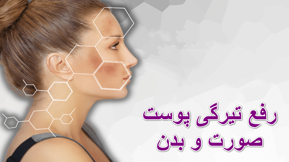 روش ها و محصولات رفع تیرگی پوست صورت و بدن