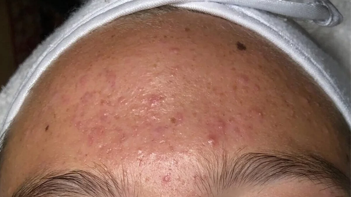 استرس و کم‌ خوابی