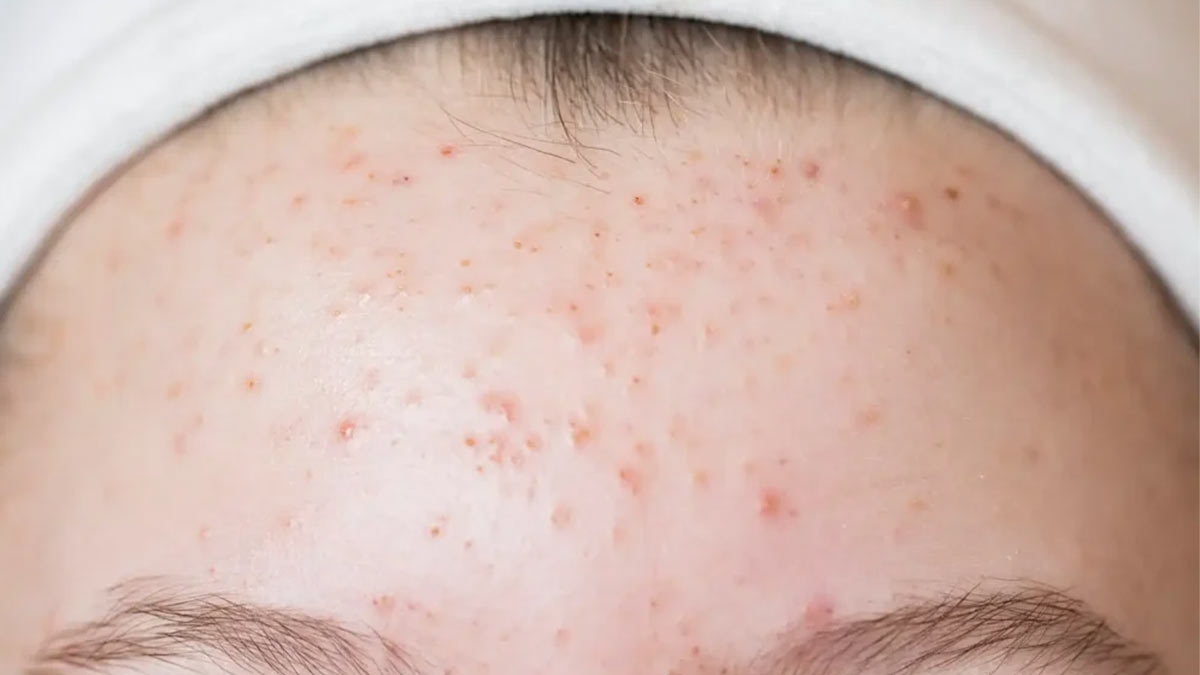 واکنش پوست به محصولات آرایشی و مراقبتی